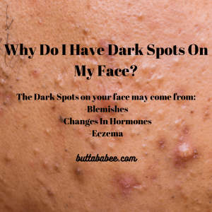 Why Do I have Dark Spots On My Face?