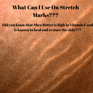 What Can I Use On Stretch Marks